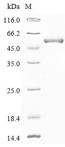 Recombinant Human Adenosine deaminase CECR1 (CECR1), partial