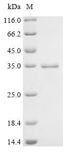 Recombinant Human Acetylcholine receptor subunit beta (CHRNB1), partial, Homo sapiens (Human), E.coli, C-terminal 6xHis-tagged, 32kDa, purity >95% as determined by SDS-PAGE.