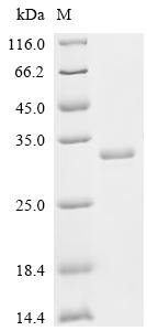Recombinant Human Acetylcholine receptor subunit beta (CHRNB1), partial