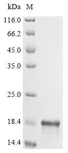 Recombinant Human Cyclin-dependent kinases regulatory subunit 1 (CKS1B)