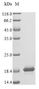 Recombinant Human Cyclin-dependent kinases regulatory subunit 2 (CKS2)