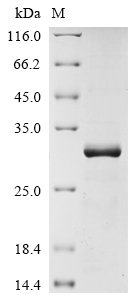 Recombinant Human Claudin-18.2 (CLDN18.2), partial