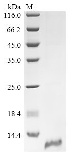 Recombinant Human Claudin-18.2 (CLDN18.2), partial