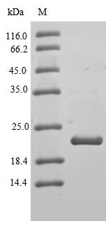 Recombinant Human Claudin-3 (CLDN3), partial, Homo sapiens (Human), E.coli, N-terminal 6xHis-B2M-tagged, 19.7kDa, purity >90% as determined by SDS-PAGE.