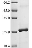 (Tris-Glycine gel) Discontinuous SDS-PAGE (reduced) with 5% enrichment gel and 15% separation gel.