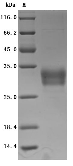 Recombinant Human C-type lectin domain family 4 member C (CLEC4C), partial (Active), Homo sapiens (Human), Mammalian cell, N-terminal 6xHis-Myc-tagged, 24.1kDa, purity >95% as determined by SDS-PAGE.