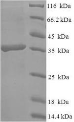 Recombinant Human C-type lectin domain family 4 member D (CLEC4D), partial, Homo sapiens (Human), E.coli, N-terminal 6xHis-SUMO-tagged, 36.7kDa, purity >90% as determined by SDS-PAGE.