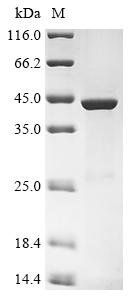Recombinant Human Ceroid-lipofuscinosis neuronal protein 5 (CLN5), Homo sapiens (Human), E.coli, N-terminal 10xHis-tagged and C-terminal Myc-tagged, 44.1kDa, purity >85% as determined by SDS-PAGE.