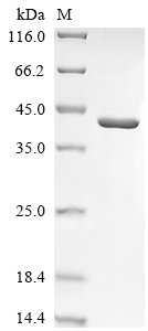 Recombinant Human Ceroid-lipofuscinosis neuronal protein 5 (CLN5), Homo sapiens (Human), E.coli, C-terminal 6xHis-tagged, 43.5kDa, purity >90% as determined by SDS-PAGE.