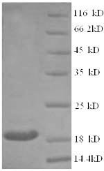 Recombinant Human Clathrin heavy chain 2 (CLTCL1), partial