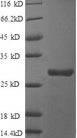 Recombinant Human Clusterin (CLU), partial, Homo sapiens (Human), E.coli, N-terminal 6xHis-tagged, 27.8kDa, purity >90% as determined by SDS-PAGE.