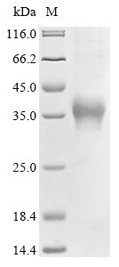 Recombinant Human Clusterin (CLU), Homo sapiens (Human), Mammalian cell, C-terminal 6xHis-tagged, 52.3kDa, purity >85% as determined by SDS-PAGE.