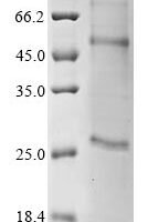 (Tris-Glycine gel) Discontinuous SDS-PAGE (reduced) with 5% enrichment gel and 15% separation gel.