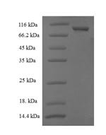 Recombinant Human Cytosolic non-specific dipeptidase (CNDP2)