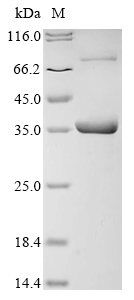Recombinant Human Conserved oligomeric Golgi complex subunit 5 (COG5), partial