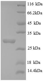 Recombinant Human Collagen alpha-3 (IV) chain (COL4A3), partial, Homo sapiens (Human), E.coli, N-terminal 6xHis-tagged, 30.6kDa, purity >90% as determined by SDS-PAGE.