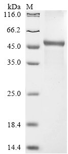 Recombinant Human Collagen alpha-2 (VI) chain (COL6A2), partial