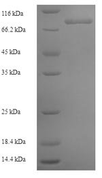 Recombinant Human Collagen alpha-6 (VI) chain (COL6A6), partial