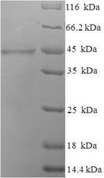 Recombinant Human Collectin-10 (COLEC10)