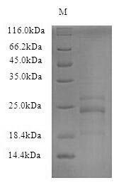 Recombinant Human COMM domain-containing protein 4 (COMMD4), partial