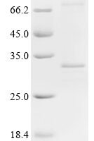 (Tris-Glycine gel) Discontinuous SDS-PAGE (reduced) with 5% enrichment gel and 15% separation gel.