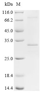 Recombinant Human ATP synthase subunit C lysine N-methyltransferase (ATPSCKMT) Protein, Homo sapiens (Human), in vitro E.coli expression system, N-terminal 10xHis-tagged, 32.2kDa, purity >85% as determined by SDS-PAGE.