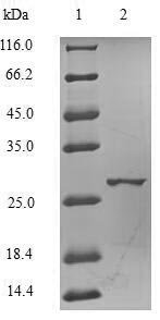Recombinant Human Catechol O-methyltransferase (COMT), partial, Homo sapiens (Human), E.coli, N-terminal 6xHis-tagged, 28.3kDa, purity >90% as determined by SDS-PAGE.