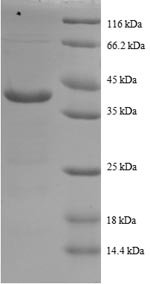 Recombinant Human Cytochrome c oxidase subunit 5A, mitochondrial (COX5A)