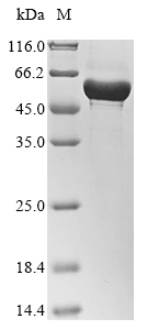 Recombinant Human Carboxypeptidase N catalytic chain (CPN1), Homo sapiens (Human), E.coli, N-terminal 10xHis-tagged and C-terminal Myc-tagged, 57.5kDa, purity >85% as determined by SDS-PAGE.