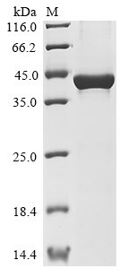Recombinant Human Carboxypeptidase N catalytic chain (CPN1), partial, Homo sapiens (Human), E.coli, Tag-Free, 45.6kDa, purity >85% as determined by SDS-PAGE.