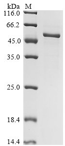 Recombinant Human Carboxypeptidase N catalytic chain (CPN1)