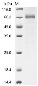 Recombinant Human Cytokine receptor-like factor 2 (CRLF2), partial (Active)