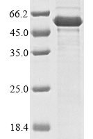 (Tris-Glycine gel) Discontinuous SDS-PAGE (reduced) with 5% enrichment gel and 15% separation gel.