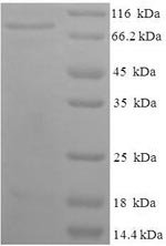 Recombinant Human Dihydropyrimidinase-related protein 1 (CRMP1)