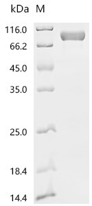 Recombinant Human Cytotoxic and regulatory T-cell molecule (CRTAM), partial, Homo sapiens (Human), Mammalian cell, C-terminal hFc1-tagged, 58.9kDa, purity >95% as determined by SDS-PAGE.
