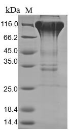 Recombinant Human Macrophage colony-stimulating factor 1 receptor (CSF1R), partial