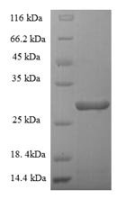 Recombinant Human Granulocyte-macrophage colony-stimulating factor (CSF2)