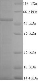 Recombinant Human Granulocyte-macrophage colony-stimulating factor receptor subunit alpha (CSF2RA), partial