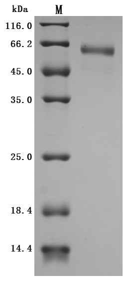 Recombinant Human Cytokine receptor common subunit beta (CSF2RB), partial (Active)