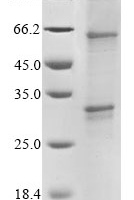 (Tris-Glycine gel) Discontinuous SDS-PAGE (reduced) with 5% enrichment gel and 15% separation gel.