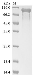 Recombinant Human Granulocyte colony-stimulating factor receptor (CSF3R), partial