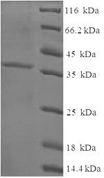 Recombinant Human Cysteine and glycine-rich protein 3 (CSRP3)