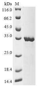 Recombinant Human Collagen triple helix repeat-containing protein 1 (CTHRC1), Homo sapiens (Human), E.coli, N-terminal 10xHis-tagged and C-terminal Myc-tagged, 30.5kDa, purity >85% as determined by SDS-PAGE.