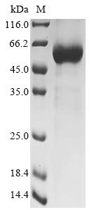 Recombinant Human Collagen triple helix repeat-containing protein 1 (CTHRC1), Homo sapiens (Human), Mammalian cell, C-terminal hFc1-tagged, 52kDa, purity >90% as determined by SDS-PAGE.