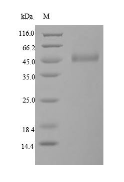 Recombinant Human Cytotoxic T-lymphocyte protein 4 (CTLA4), partial (Active)