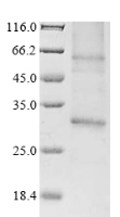 (Tris-Glycine gel) Discontinuous SDS-PAGE (reduced) with 5% enrichment gel and 15% separation gel.