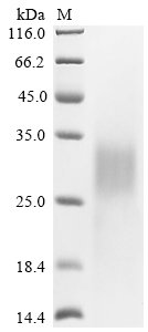 Recombinant Human Cytotoxic T-lymphocyte protein 4 (CTLA4), partial, Homo sapiens (Human), Yeast, N-terminal Twin-Strep-tagged, 17.2kDa, purity >90% as determined by SDS-PAGE.