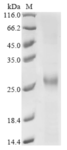 Recombinant Human Cathepsin B (CTSB), partial, Homo sapiens (Human), E.coli, Tag-Free, 27.7kDa, purity >90% as determined by SDS-PAGE.