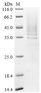 Recombinant Human Cathepsin B (CTSB)