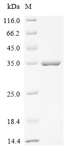 Recombinant Human C-X-C chemokine receptor type 4 (CXCR4), partial, Homo sapiens (Human), E.coli, N-terminal 6xHis-GST-tagged, 36.7kDa, purity >85% as determined by SDS-PAGE.